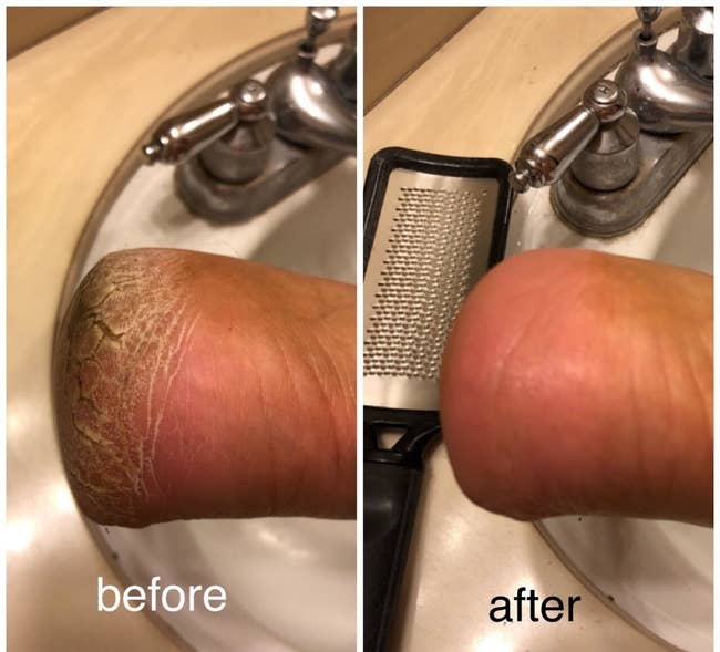 Reviewer's feet before showing deeply cracked heels and an after results of the same heel looking smooth and showing now cracks after using the foot file
