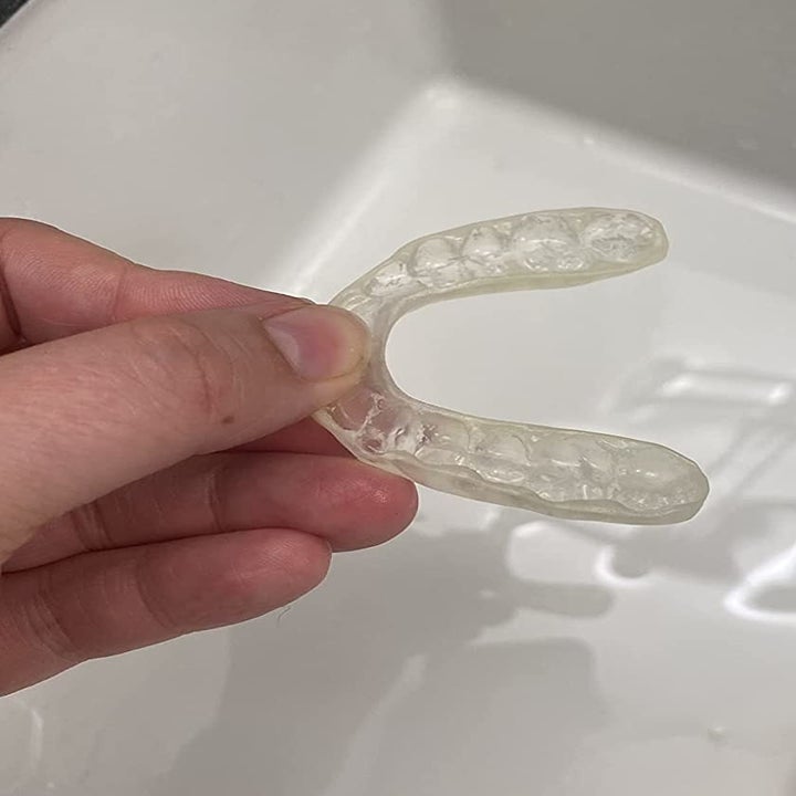 Reviewer after photo showing the same retainer looking much cleaner