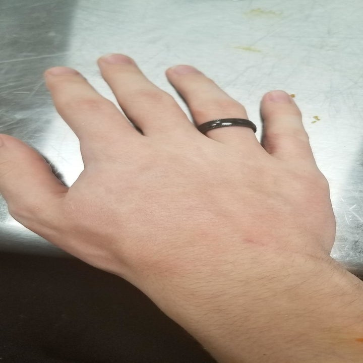 after image of reviewer's hand completely healed