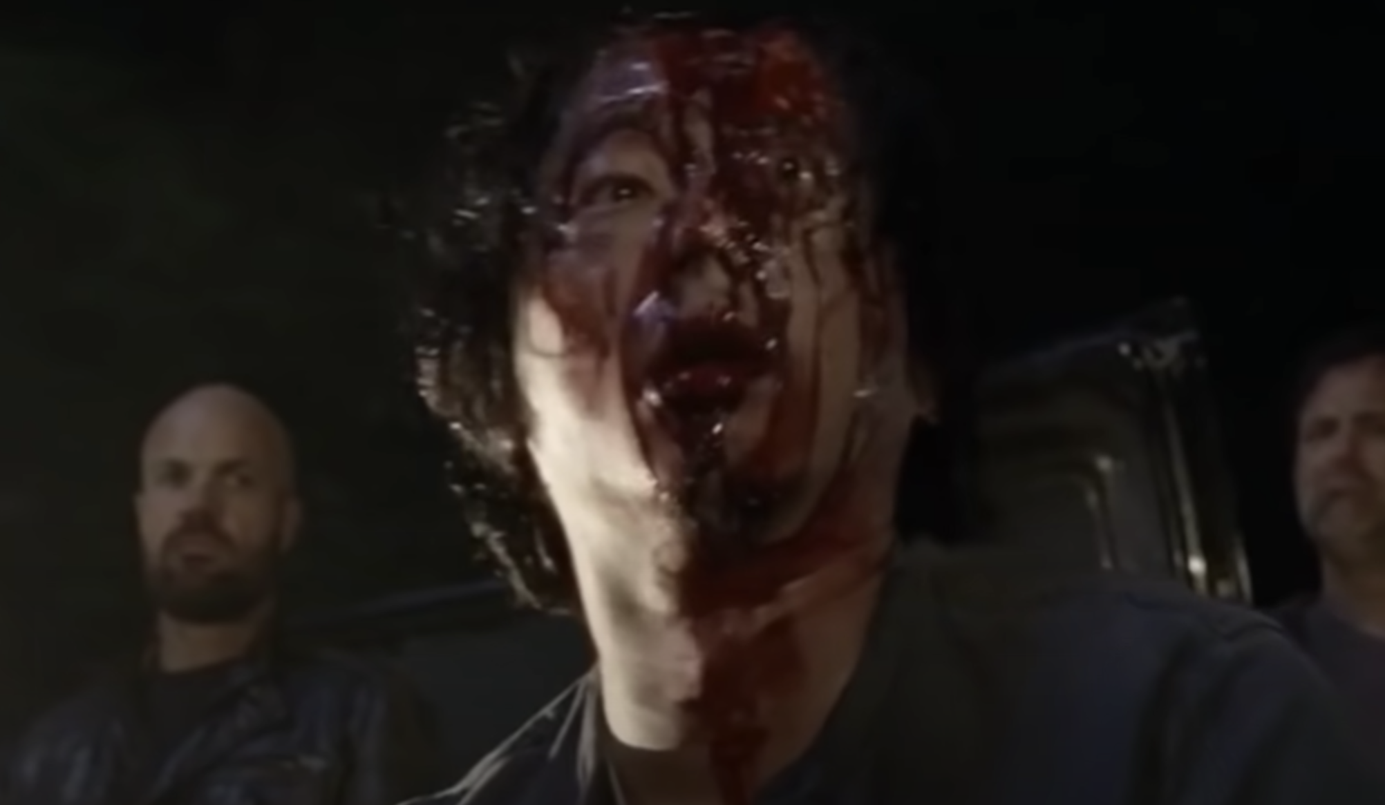 A man&#x27;s eye bulges out of his head and his face is covered in blood