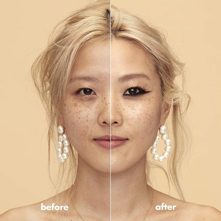 a before and after where the after shows smooth, luminous skin