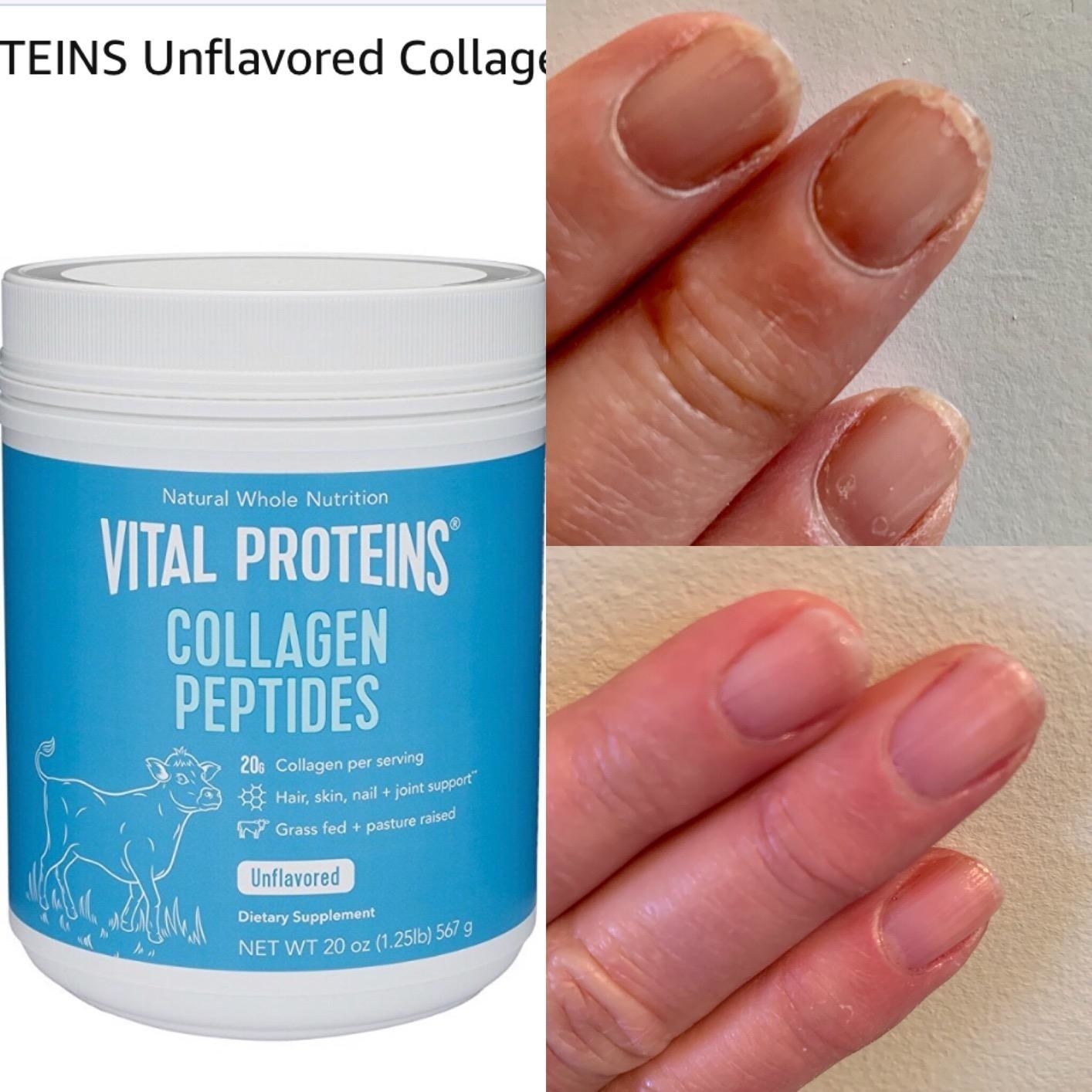 reviewer image of the collagen peptides and a before picture of cracked fingernails and an after photo of healthy nails