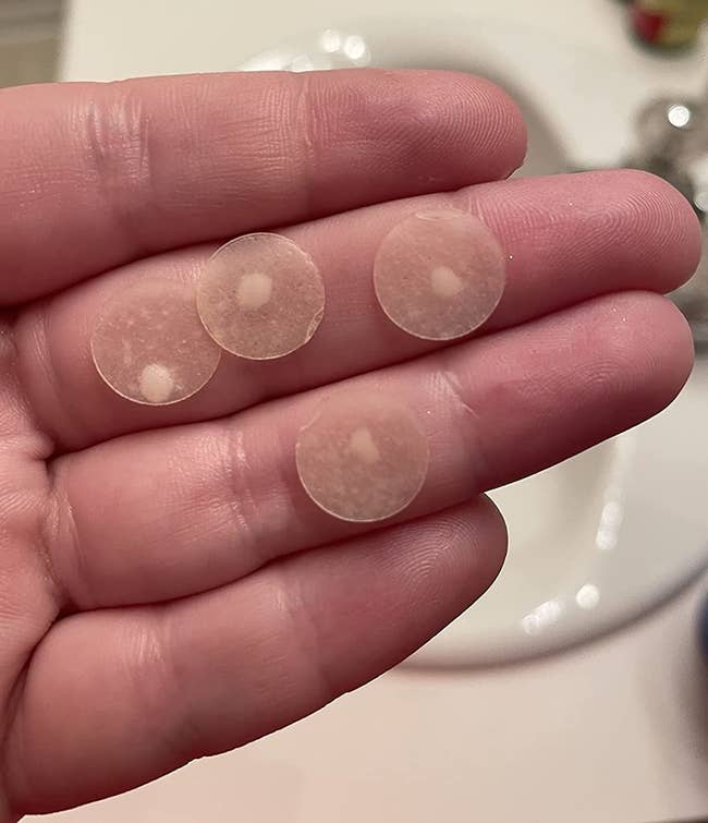 reviewer's hand holding a few loaded acne patches