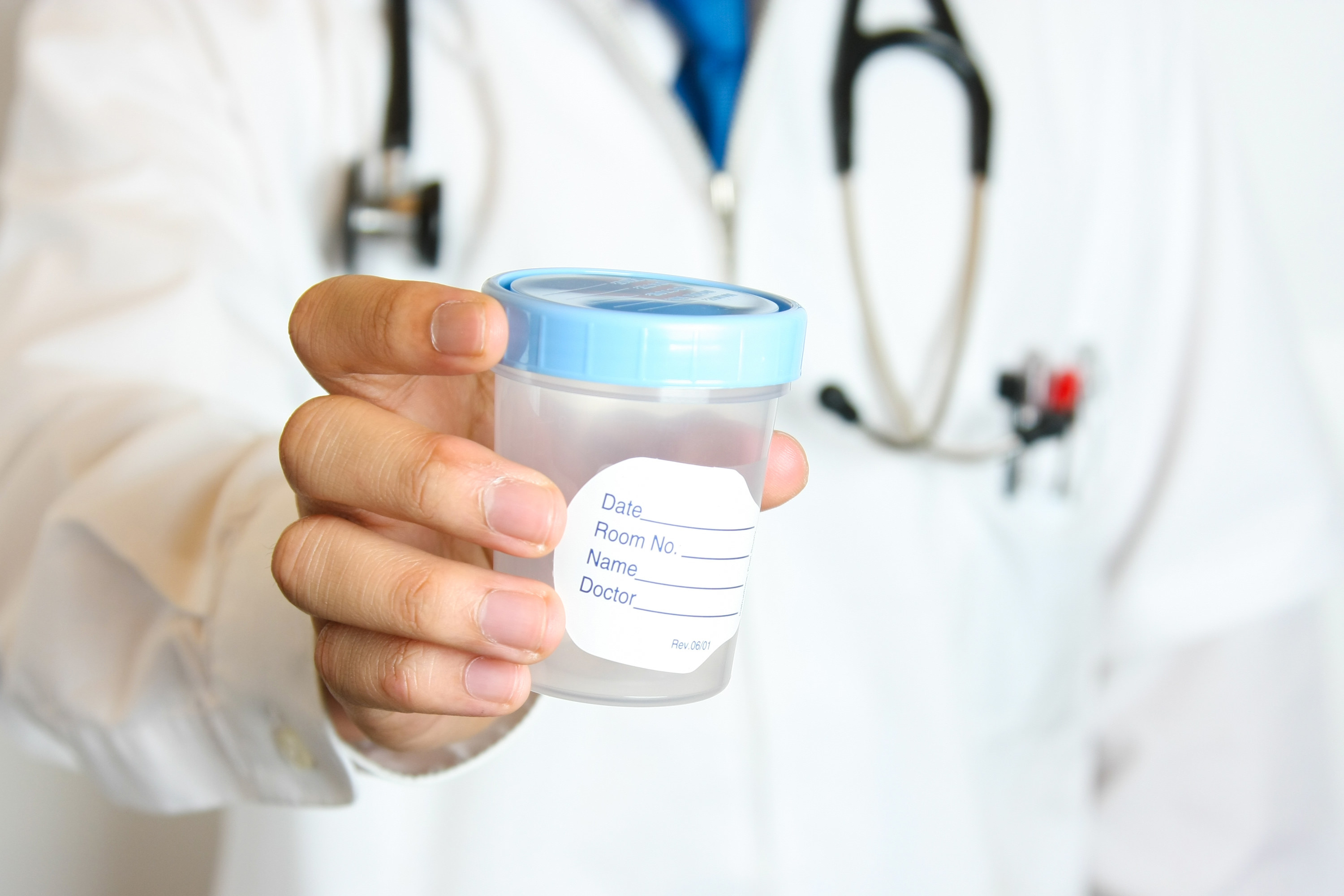 doctor holding a collection cup for a sample