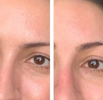 Reviewer showing results of using Revlon volcanic facial roller making their face much more matte