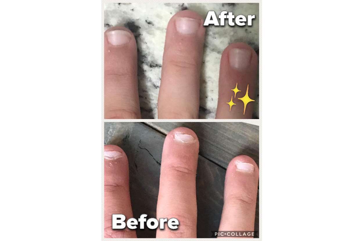 Before & after WEDDING DAY NAILS 👰 – Mel's Nail Co