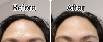 A series of customer review before and after photos showing their forehead greasy and then matte after use of the roller