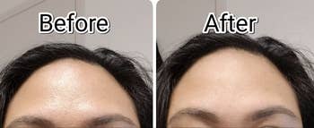 Reviewer's before and after photos showing their forehead greasy and then matte after use of the roller