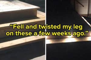 A person who fell and twisted their leg on a set of deck stairs