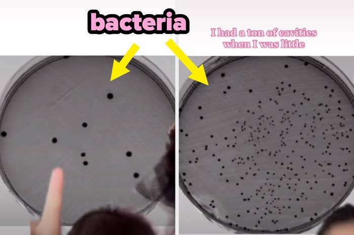 Dr. Joyce&#x27;s petri dish, full of bacteria, side-by-side with a peer&#x27;s petri dish with barely any bacteria