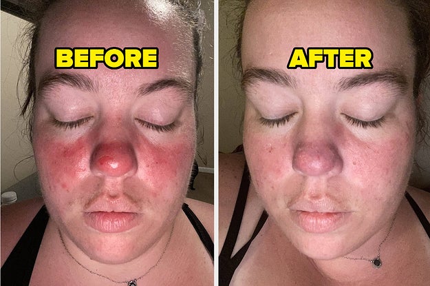 43 Products With Before-And-Afters Worth A Thousand Words - Vimarsana News