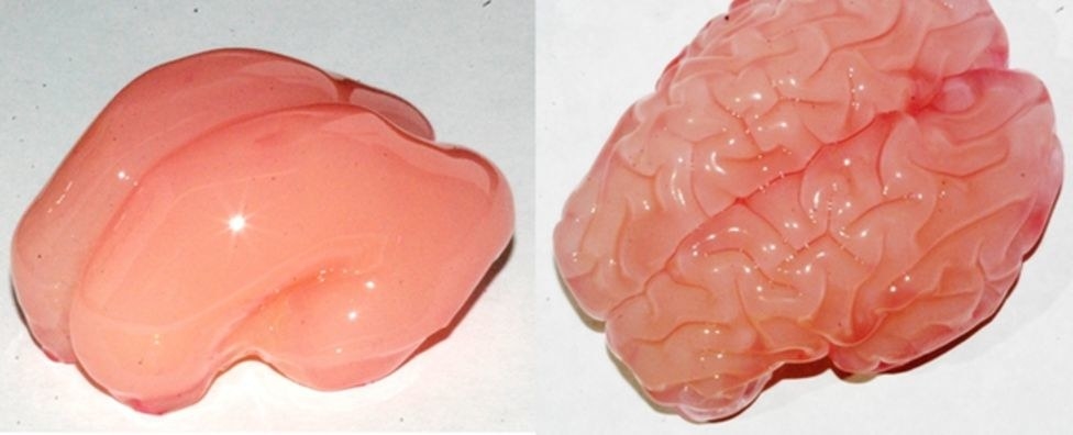 Smooth fetal brain alongside brain with wrinkles