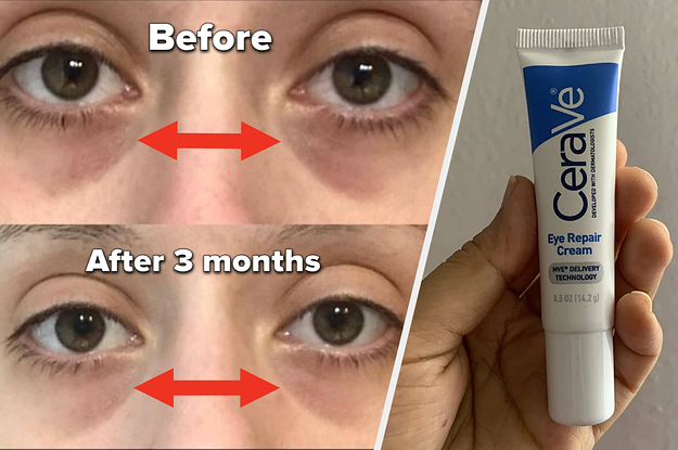 Reviewer image of split before and after image with arrows pointing to differences, reviewer holding blue and white Cerave eye cream bottle