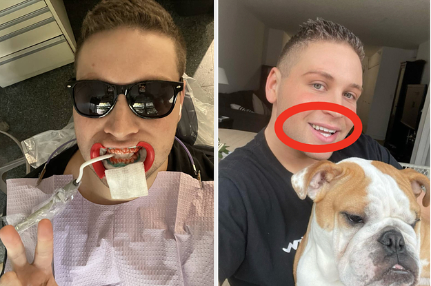 I Went To A Celebrity Dentist To Whiten My Teeth And Here's How Much It Cost, How Much It Hurt, And My Results
