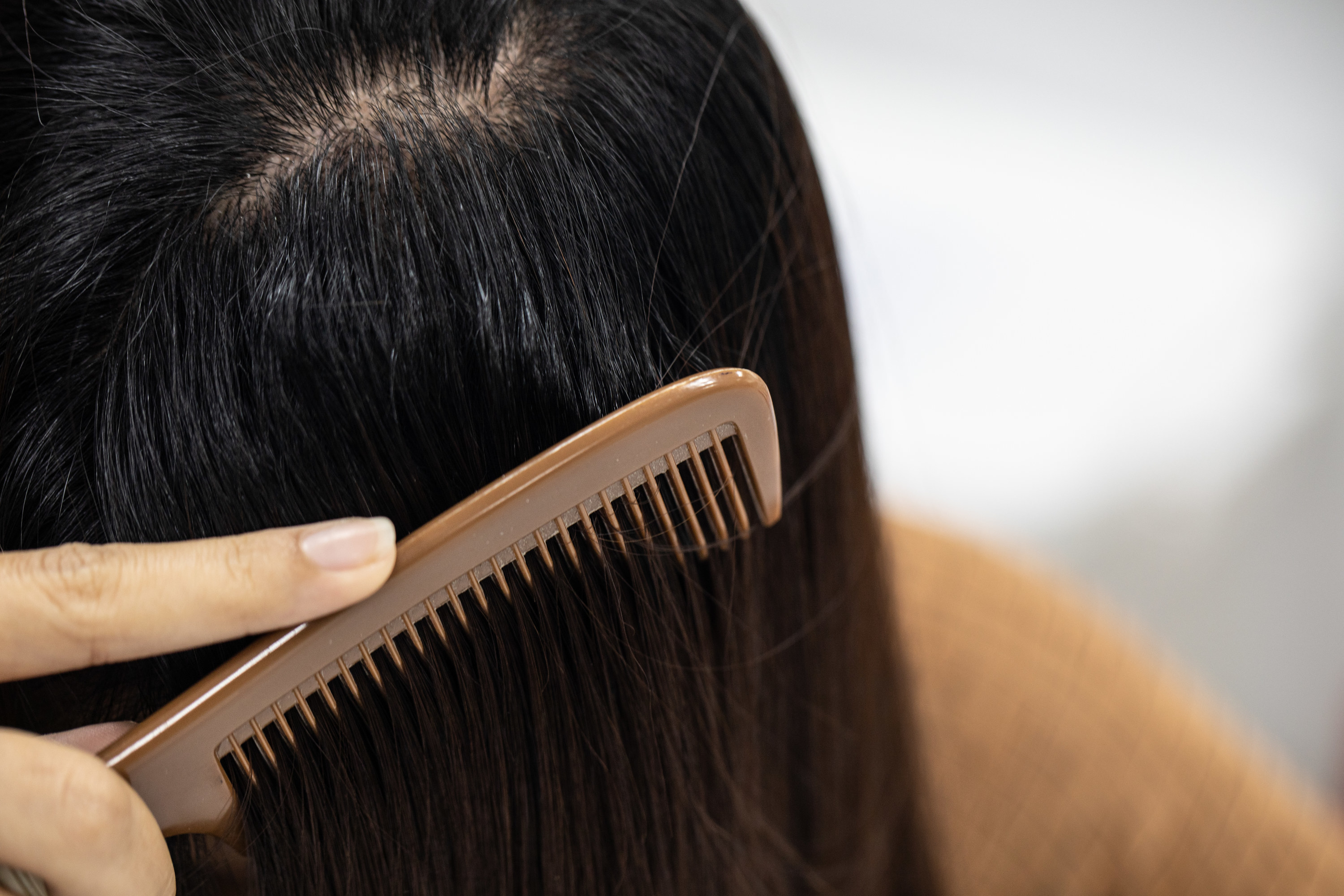 A person combing through their hair showing an oily scalp