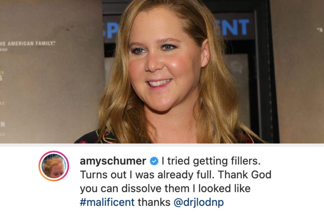 Amy Schumer Explains Why She Removed Her Facial Fillers