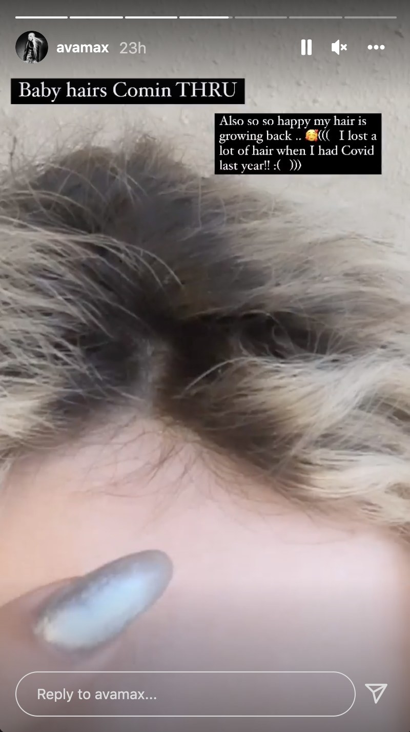 A close up of Ava&#x27;s hair line where small baby hairs can be seen