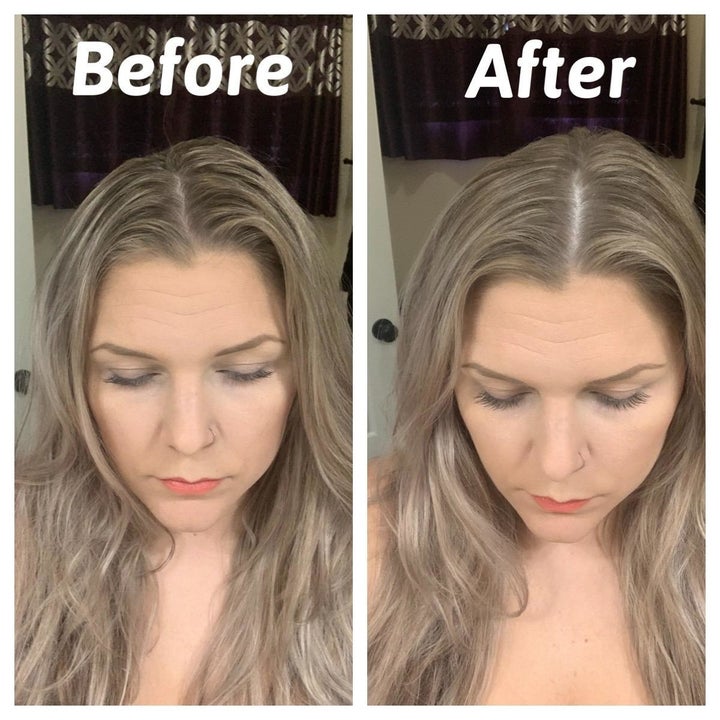 Reviewer before photo showing their oily-looking hair next to an after photo showing cleaner-looking hair