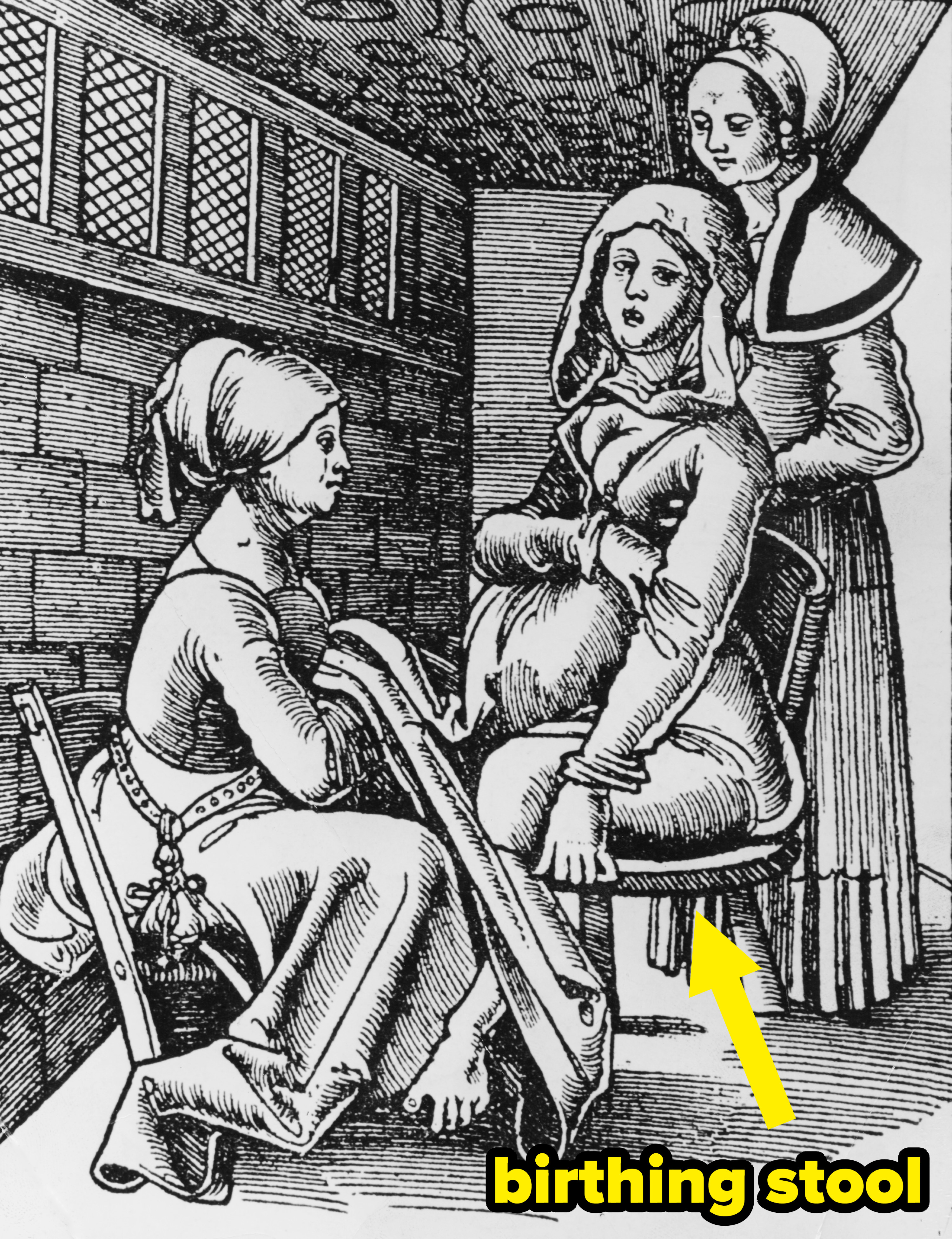 A lithograph of midwives helping a woman give birth on a birthing stool