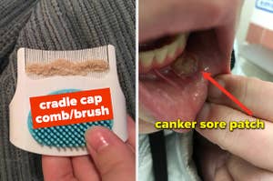 a cradle cap comb and a canker sore patch