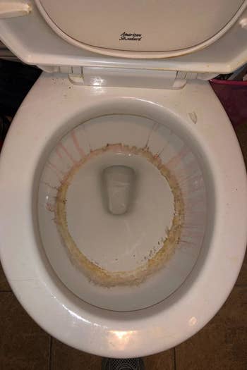 a reviewer image of a toilet bowl with a dark brown ring