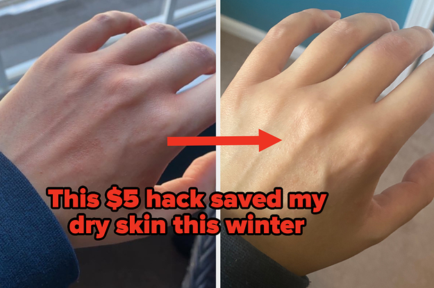 I Tried "Slugging," The Viral Vaseline Moisturizing Hack, And My Skin Is Literally Glowing