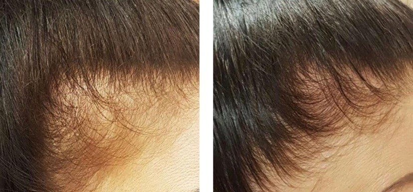 reviewer before and after photos showing their hair looking much thicker after using the shampoo