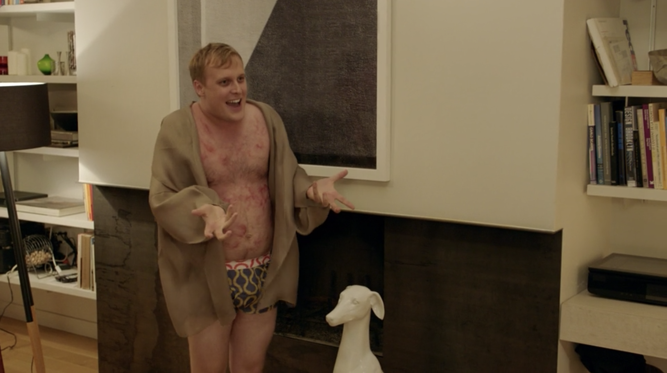 John Early in a robe with rashes on his body.