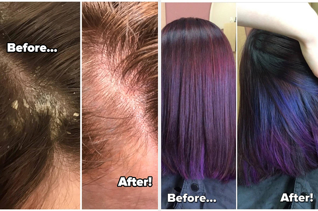 before and after photos showing a reviewer's flaky scalp next to their scalp looking flake-free / before and after photos of a reviewer's dyed hair looking less vibrant next to it looking much shinier