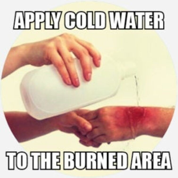 Meme of water being poured on a burned hand, with the caption &quot;Apply cold water to the burned area&quot;