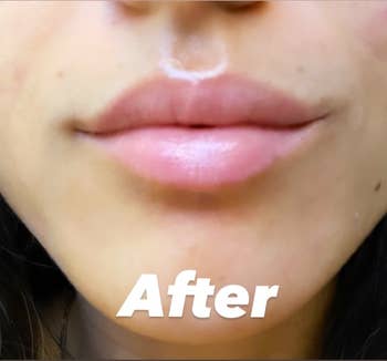 Jasmin the next morning with visibly softer, fuller lips