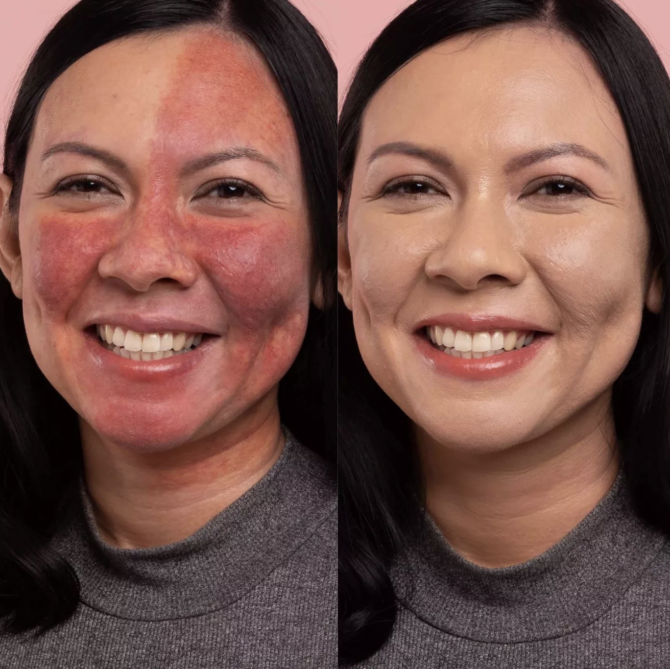 A woman showing before and after images of her face with using CC cream