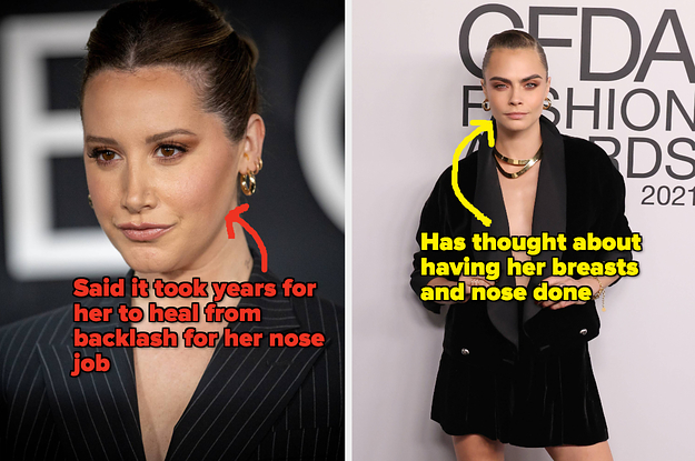 36 Times Celebrities Opened Up About Plastic Surgery On The Record