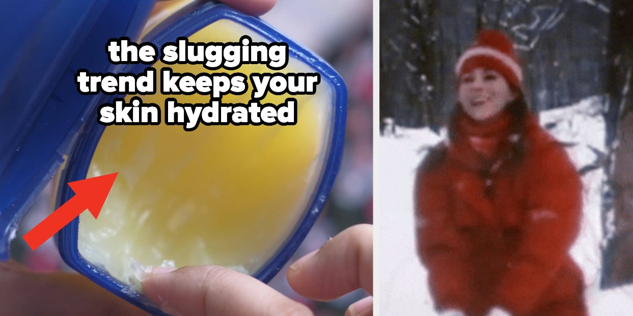 Skincare Experts Are Sharing Easy Ways You Can Relieve Dry, Itchy Skin And Soothe Chapped Lips This Winter