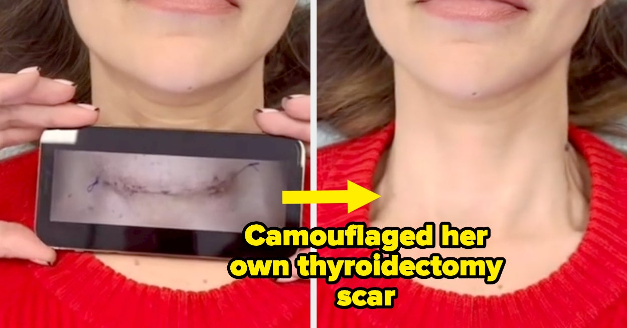 This Paramedical Tattoo Artist Camouflages Scars