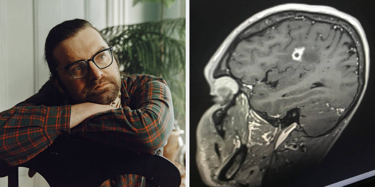 Black Mold Growing In Brain After Vacation - Vimarsana News