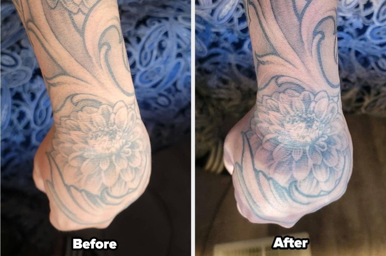 How to Remove a Permanent Tattoo Without a Laser  Tattoo Vanish