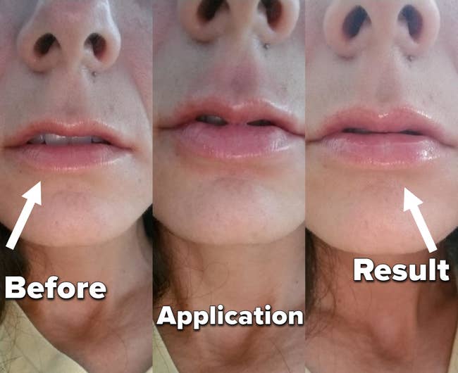 Reviewer photo before and after applying lip balm