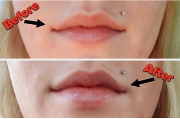 Before and after of reviewer after applying lip plumper