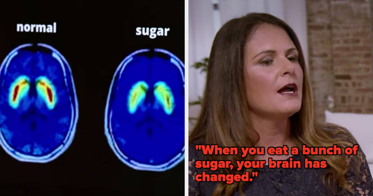 Dr. Nicole Avena talks to Jonathan about how sugar impacts the brain