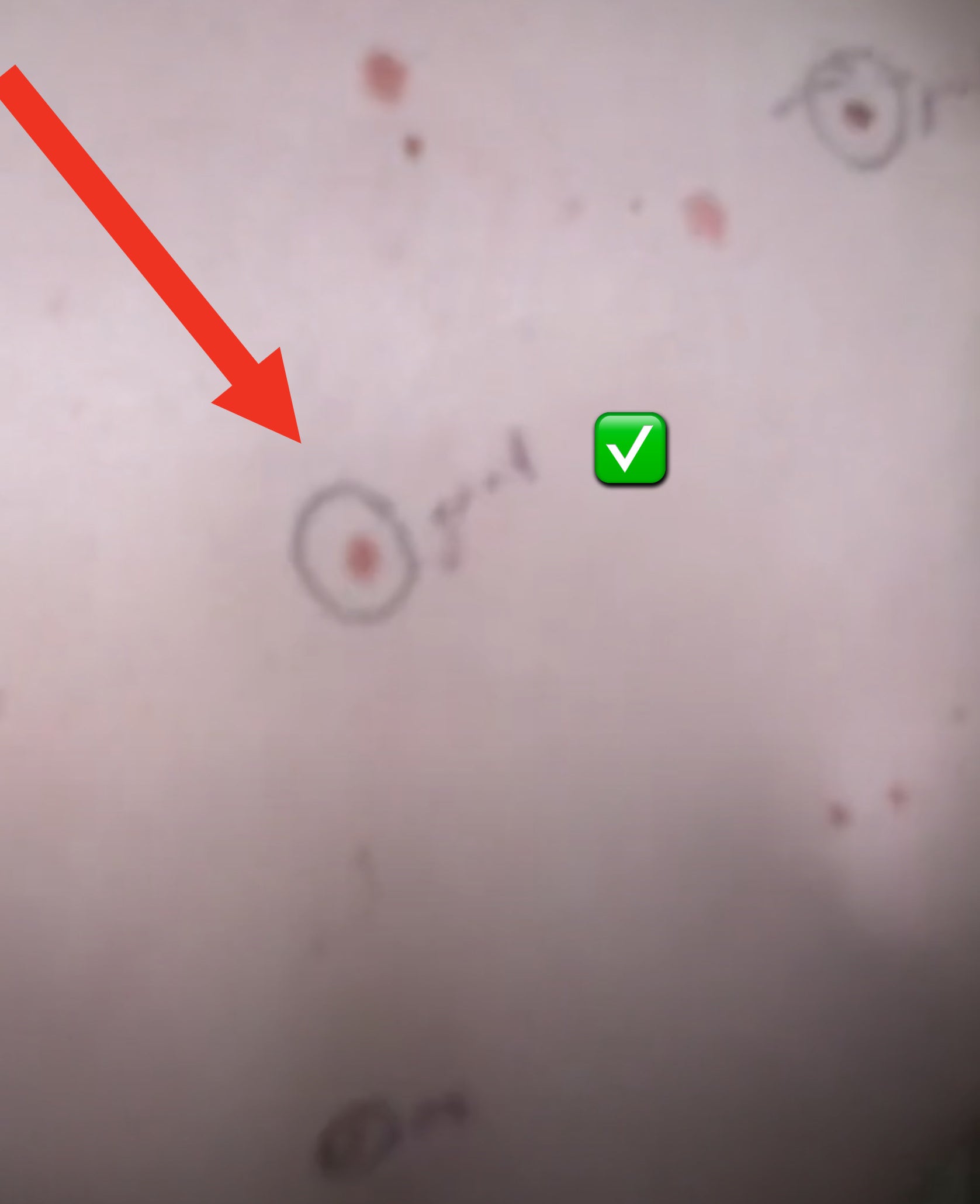 One mole with the word good written next to it on Ryan&#x27;s back