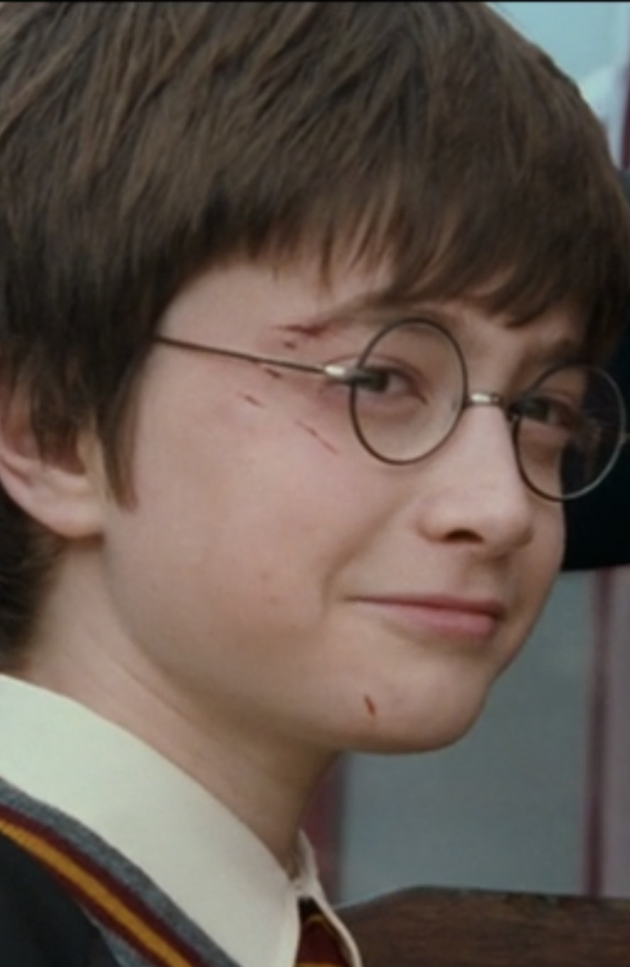 Radcliffe with glasses and multiple scars on his face