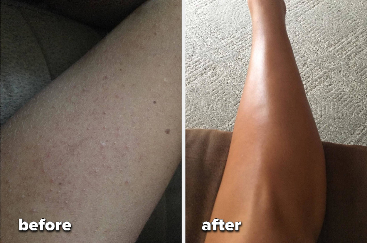 a before and after of a reviewer&#x27;s dry, coarse skin and then sleek and smooth after using towel