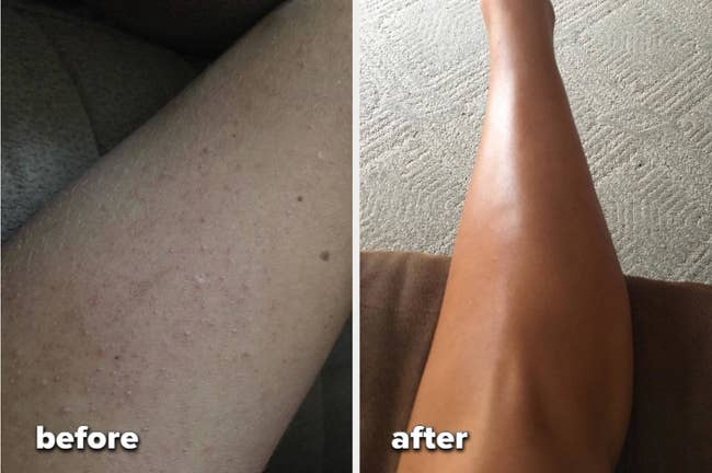 a before and after of a reviewer's dry, coarse skin and then sleek and smooth after using towel