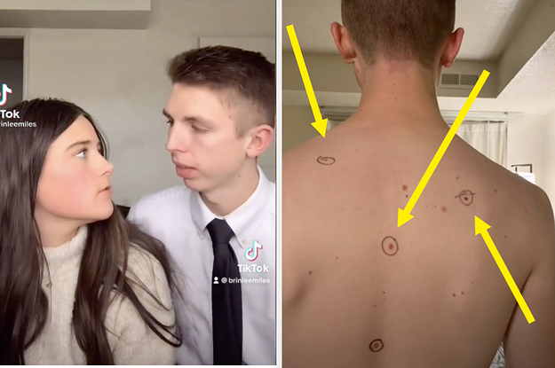 This Wife Circled Her Husband's Moles Before His Dermatology Appointment, And The Doctor Sent Him Back With Notes On His Body