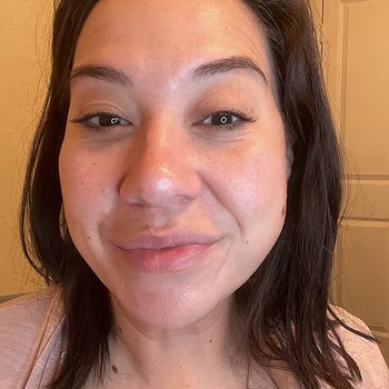 same reviewer's after photo showing their skin looking much brighter and more even