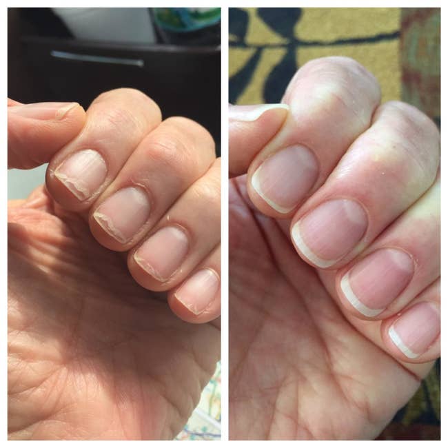 reviewer photo showing their nails dry and cracked, and then weeks later looking perfectly healthy and shiny after using the Cuticle Care