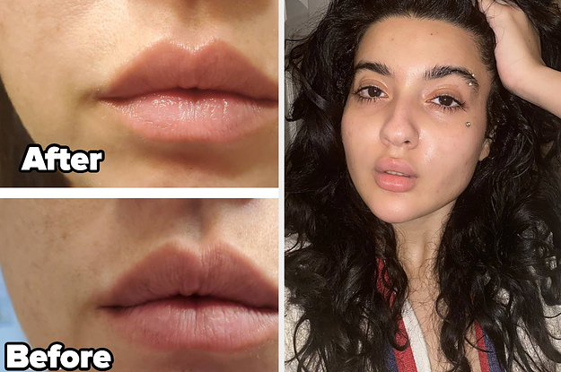 reviewer's before and after photos showing their lips looking dry and then looking hydrated / reviewer showing their dewy looking skin