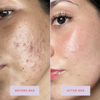 before and after person using facial spray