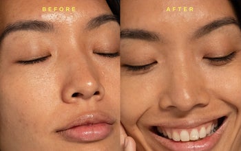 before and after of a model showing what them with and without the product on their face